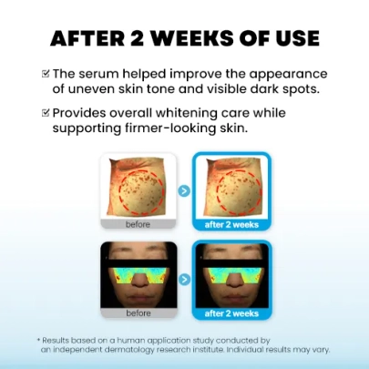 [PRO-CALM] Осветляющая увлажняющая сыворотка Mela Whitening Moisture Serum 20мл