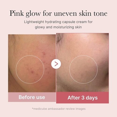 [MEDICUBE] *renewal* Капсульный крем PDRN Pink Capsule Cream 55гр