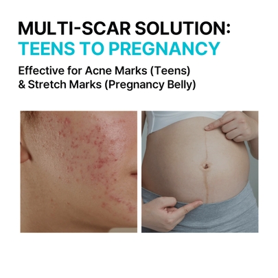 [MILDLAB] Гель для ухода за рубцами Scar Coat Gel 10г