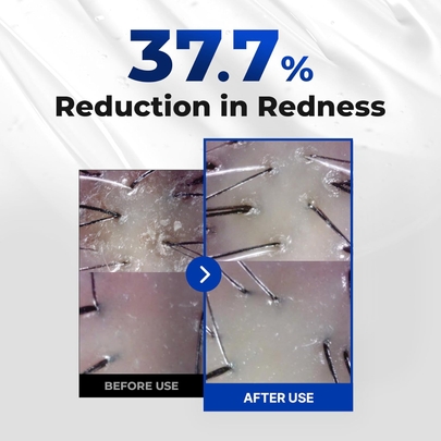 [epais] Интенсивная ампула для кожи головы 15мл