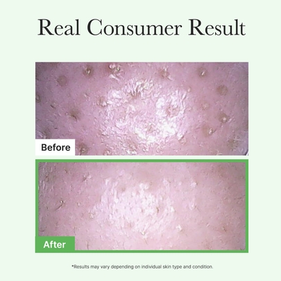 [ARENCIA] Двойной дуо-набор гидрофильного масла Pore Melt Mochi Cleansing Oil (200 мл + 200 мл)