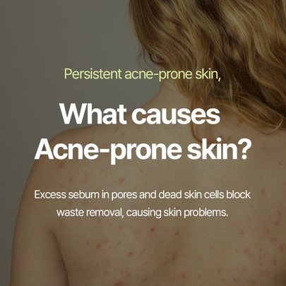 [Pyunkang Yul] Гель для душа Calming Acne Clear Body Wash 290 мл