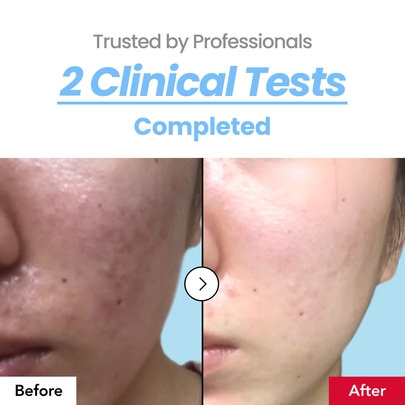 [Dr.Percent] Успокаивающий тонер Soothing 10% Toner 300 мл