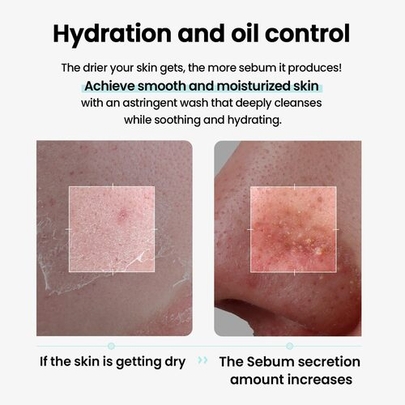 [ILSO] Очищающее масло для растворения себума Super Melting Sebum Cleansing Oil 200 мл