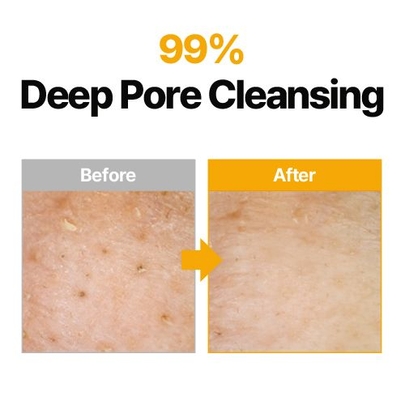 [ma:nyo] Pure Cleansing Oil 200 мл (3 шт.)