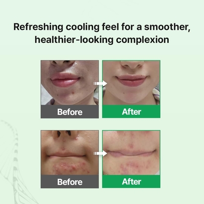 [zipiderm] Увлажняющий крем EGF Skin Barrier Hydrating Cream 80 мл