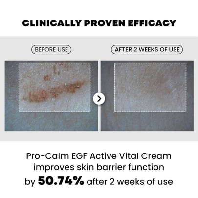 [PRO-CALM] Набор EGF Daily Firming Trio (маска + крем + SPF)