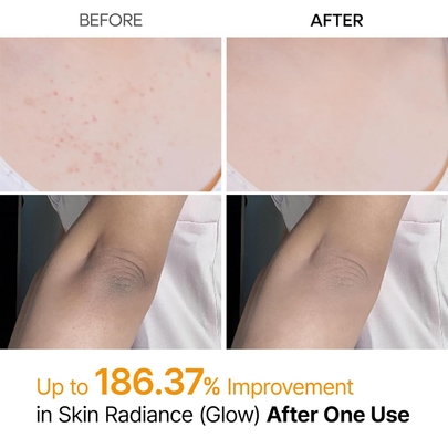 [Dr.Melaxin] Отшелушивающий спрей Peel Shot Exfoliating Kojic Acid Turmeric Spray 200 мл