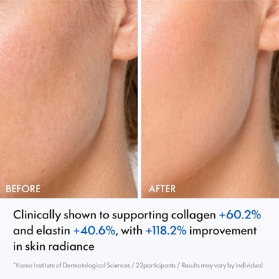[JUVELOOK] PDLLA Collagen Ampoule, 20 мл