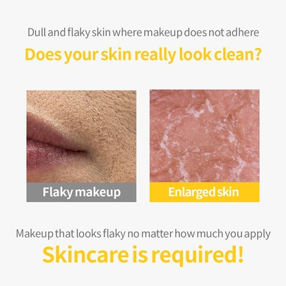 [Secret Key] Пилинг-гель с лимоном Lemon Sparkling Peeling Gel (150 мл)