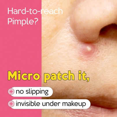 [Troubless] Точечные патчи Invisible Plus Spot the Micro Signature (123 шт.)