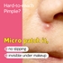 [Troubless] Точечные патчи Invisible Plus Spot the Micro Signature (123 шт.)