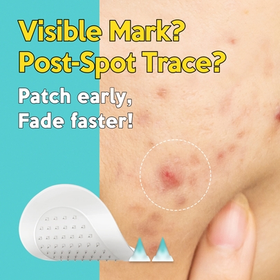 [Troubless] Точечные микропатчи Micro-Point Patch Plus Vitamin C 10% от пигментации (9 шт.)