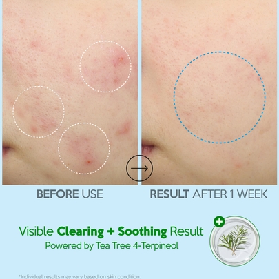 [Troubless] Увлажняющий успокаивающий крем Hydro Soothing 80 мл