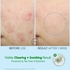 [Troubless] Увлажняющий успокаивающий крем Hydro Soothing 80 мл