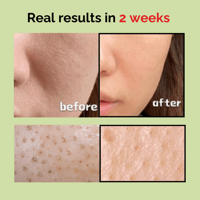 [mommy care] Ампула для сужения пор Sea Grape 50 мл