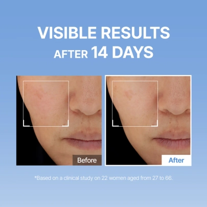[MEDITHERAPY] Сыворотка-бустер с гиалуроновой кислотой Hyaluronic Acid First Skin Booster 150 мл