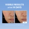 [MEDITHERAPY] Сыворотка-бустер с гиалуроновой кислотой Hyaluronic Acid First Skin Booster 150 мл