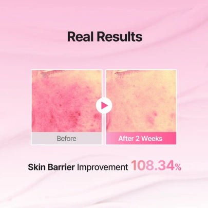 [MEDITHERAPY] Крем Porethera Real Bifida Pink Blur 50 мл